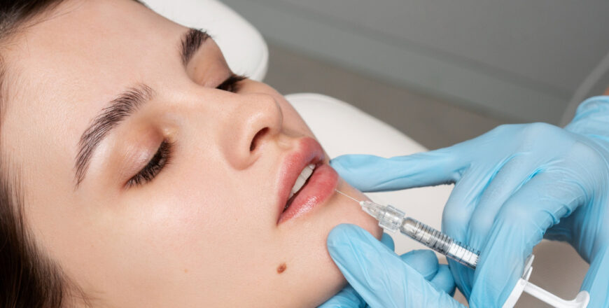 lip-filler-.jpg