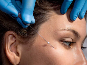 undereye-threads-basic.jpg