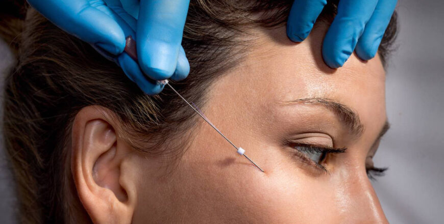 undereye-threads-basic.jpg